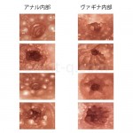 ミラクルエンジェル美尻〜ヒップ〜　内部構造